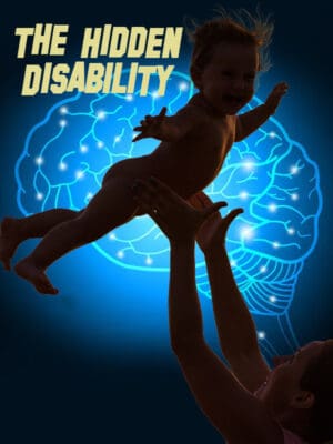FASD - The Hidden Disability